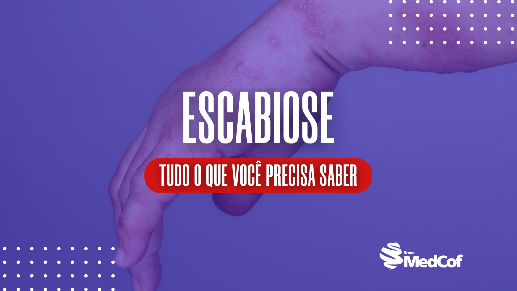 Escabiose tudo que você precisa saber Blog Grupo MedCof