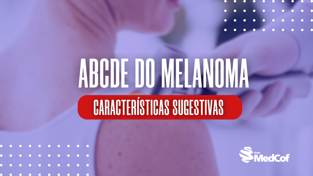 melanoma, cancer de pele melanoma, fotos de câncer de pele melanoma, fotos melanoma, melanona de pele, cancer melanoma, melanoma cancer de pele