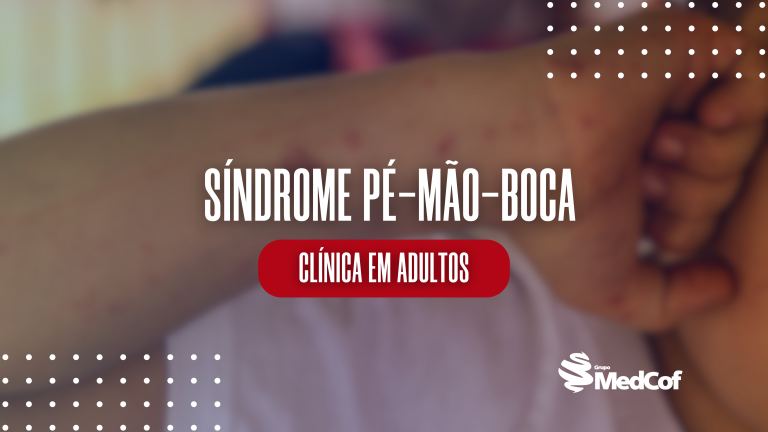 Síndrome mão-pé-boca: clínica em adultos - Blog de Medcof: conteúdos ...