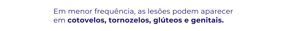 sindrome do pé mão e boca, Síndrome mão-pé-boca, síndrome mão-pé-boca complicações, síndrome mão pé boca, síndrome mão-pé-boca, síndrome mão pé e boca,