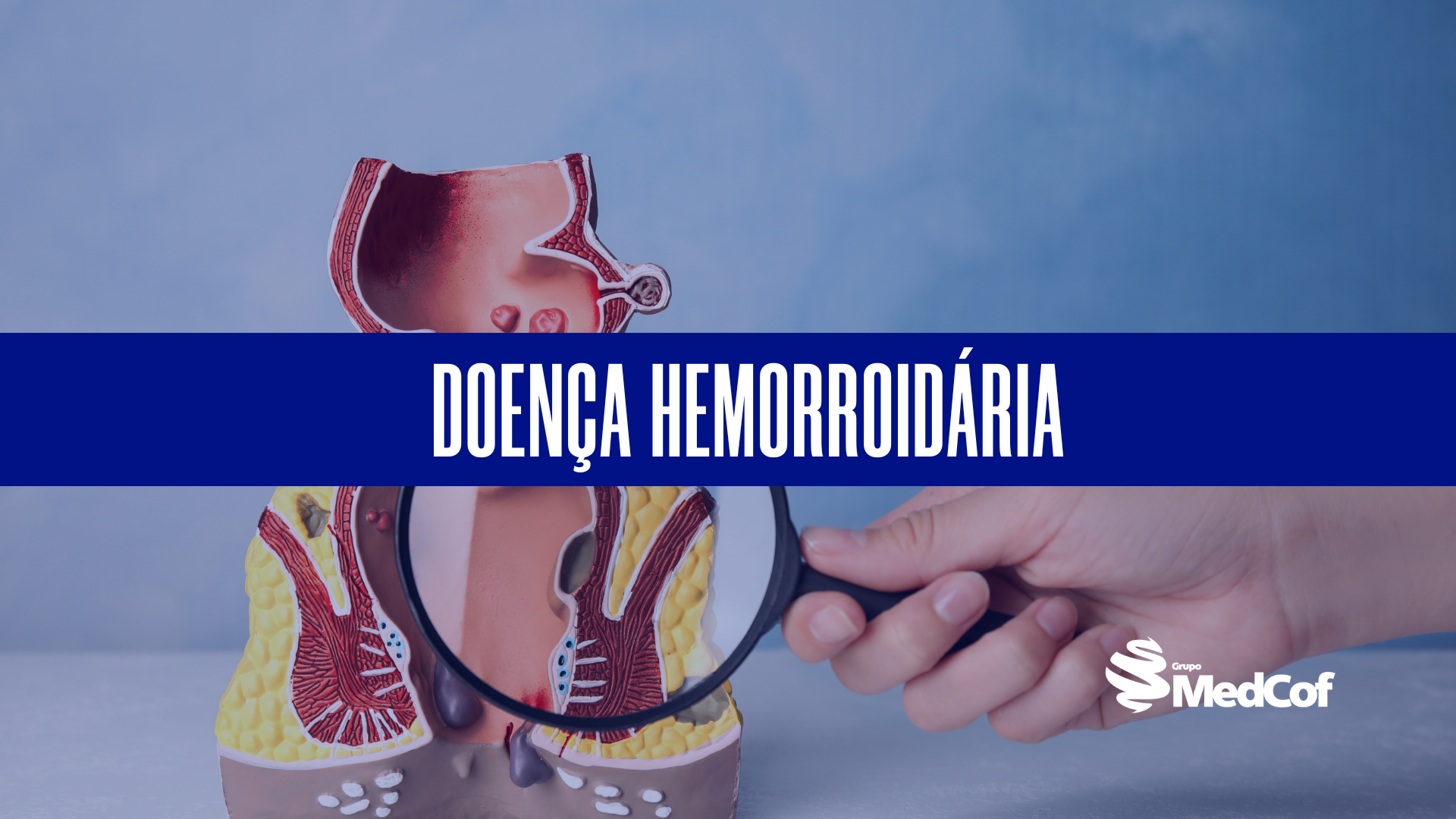 Doença Hemorroidária: Causas, Sintomas, Diagnóstico e Tratamento - Blog ...
