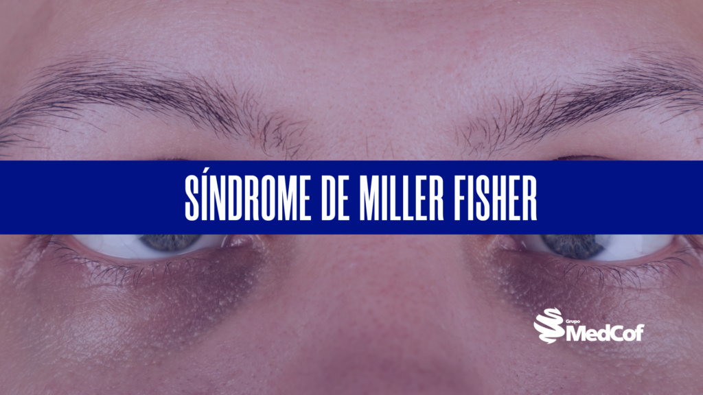 síndrome-de-miller-fisher